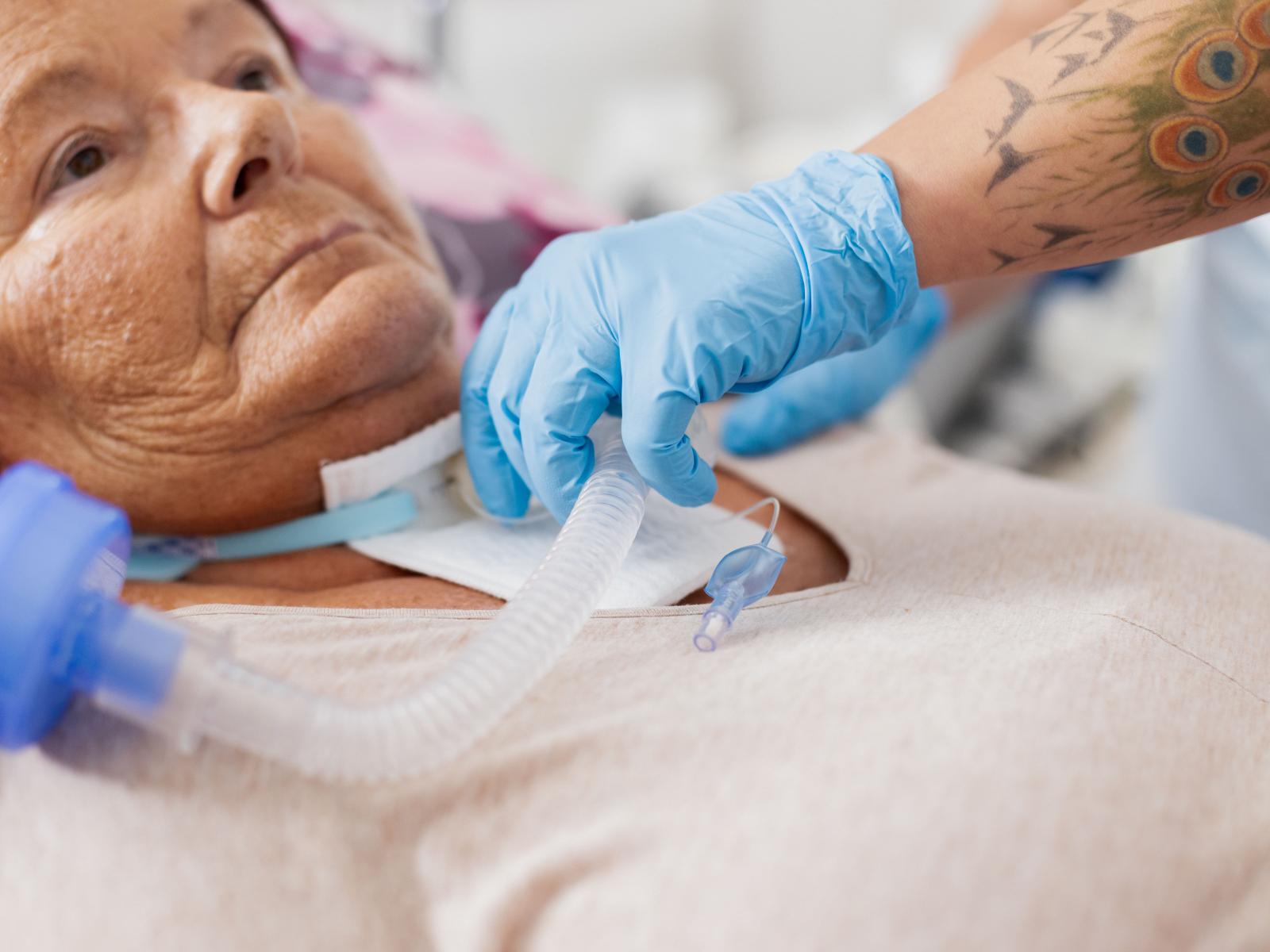 Pflege-einer-tracheostomierten_Patientin